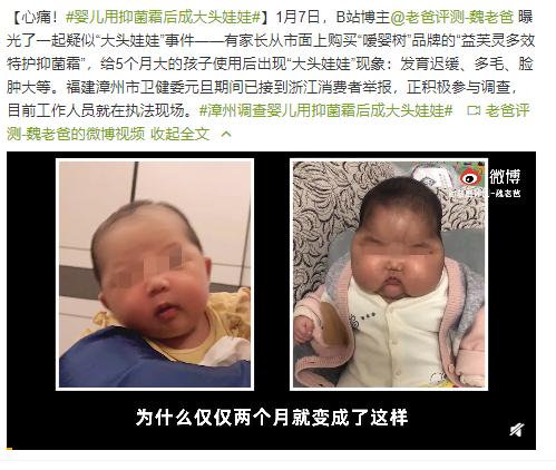 婴儿湿疹能用多效霜吗,婴儿湿疹用除湿止痒洗剂好吗