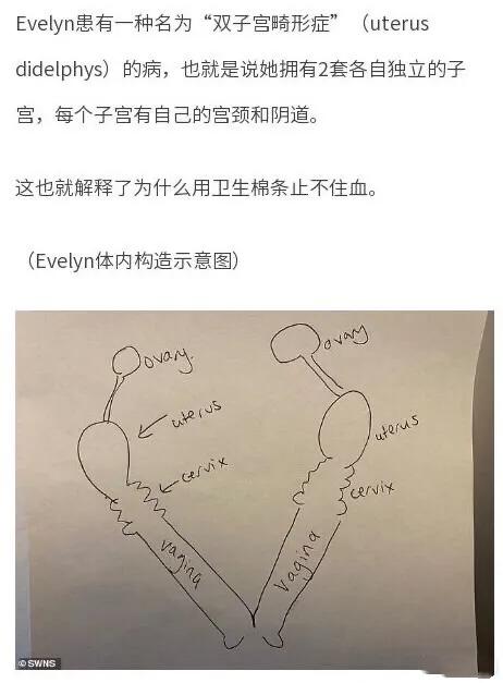 王者荣耀举报dota2,王者荣耀玩家玩dota2被反补