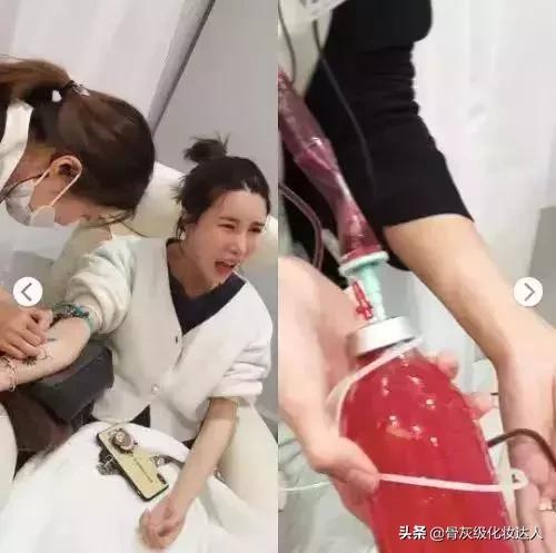 深扒小红书！灌肤、微针美白、换血，请问你不怕死吗？！
