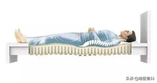 PGone：一不小心闪了腰，我该怎么办？