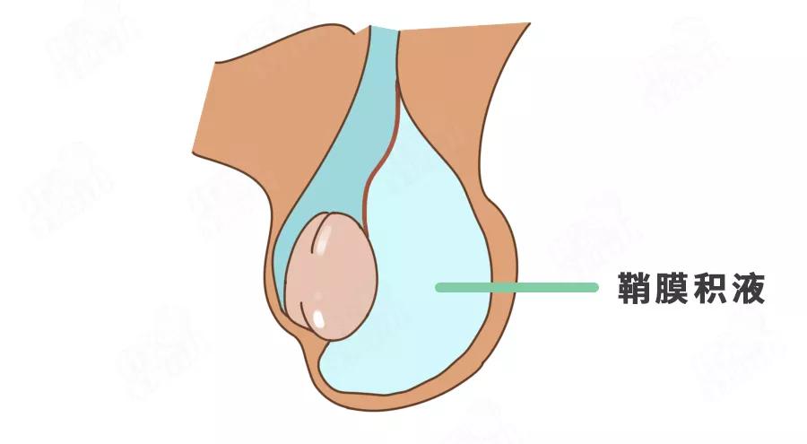 蛋蛋一高一低、一大一小正常吗？男娃5大*处私**问题，错不起