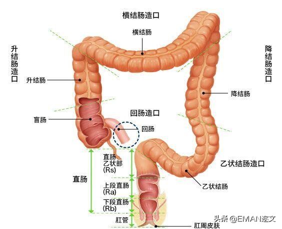 大肠癌多发肝转移10年,大肠癌发病率逐年攀升