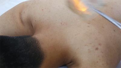 一看就会手把手教拔罐疗法,学拔罐视频教程全集