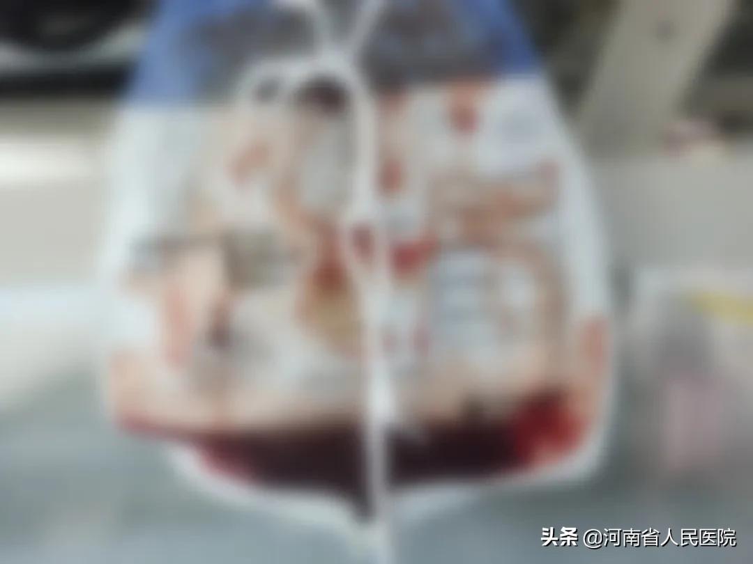 急性心梗做了支架却还是死亡,急性心梗抢救过来必须做手术么