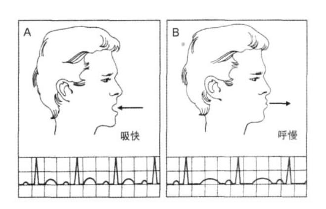 室上速心跳加速,心跳快表明心率高吗