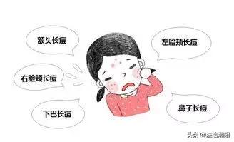 *毒冰**疮、*古麻**痘，拿什么来拯救这张脸？