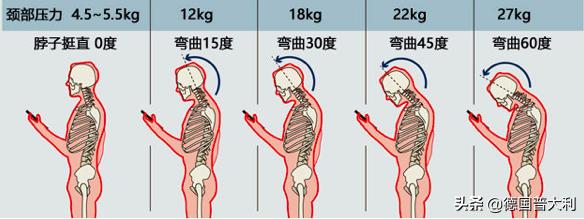 乌龟脖到底还有没有救