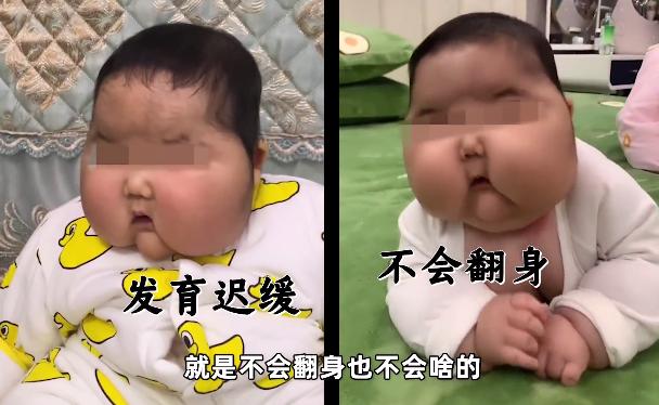 婴儿下巴湿疹可以抹贝亲屁屁霜吗,宝宝红屁股湿疹怎么处理