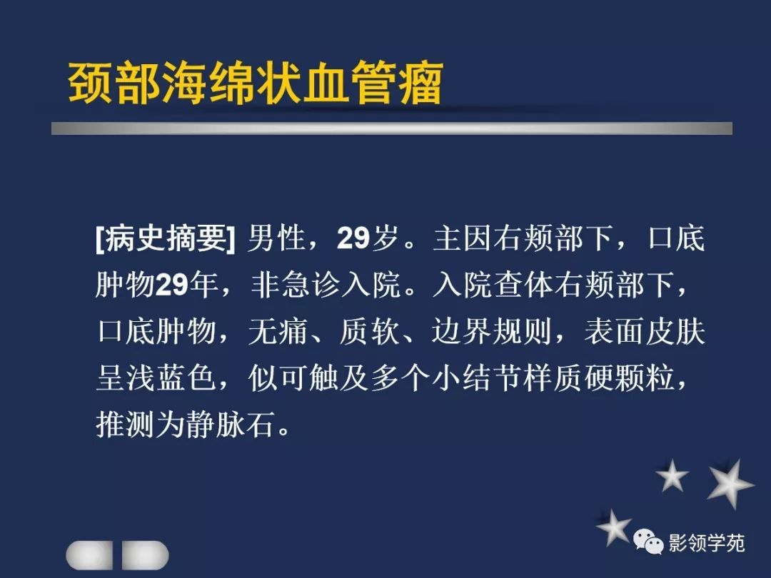 腮腺疾病影像学诊断,腮腺肿块影像诊断