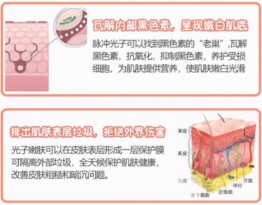 医美祛痘治疗有几种？怎么选择？超全科普告别痘肌