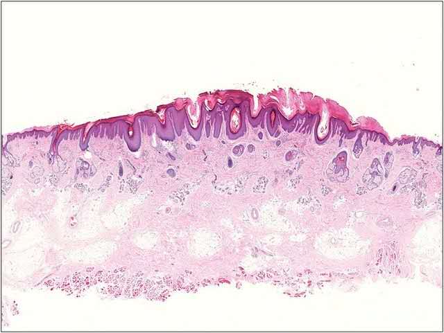 皮肤很痒不能挠怎么缓解,皮肤瘙痒的受不了怎么办