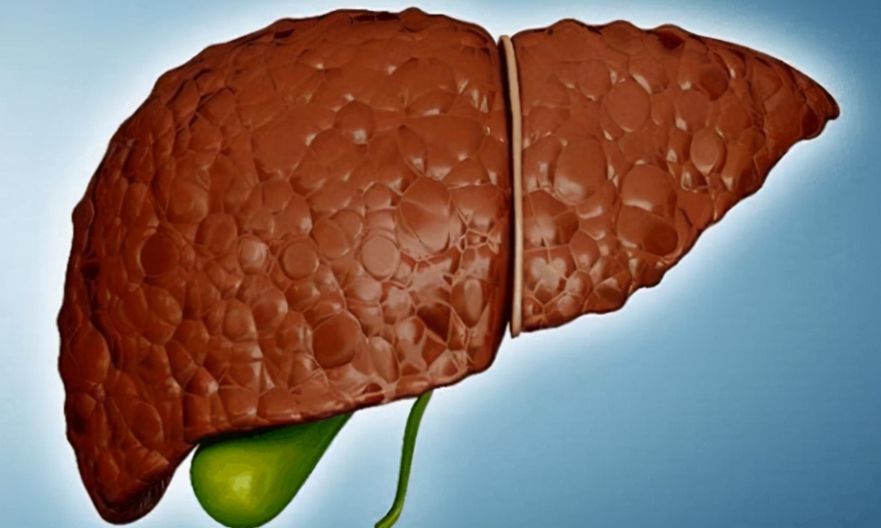 肝不好放屁还是胃不好放屁,经常放屁是不是肝出现问题了