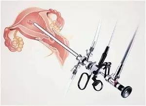 多年不孕容易长子宫肌瘤,多年不孕怎么找原因