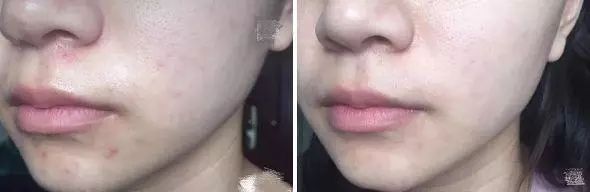 火到断货的“明星级”点斑笔,坚持每天点一下,14天养成初恋脸