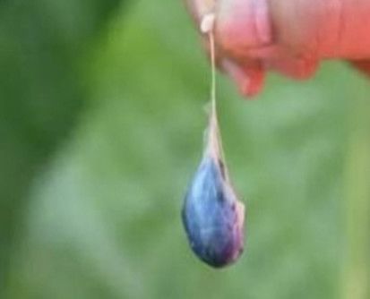 偏方不可信吞鱼胆清火致垂危,吃蛇胆取出30公分寄生虫