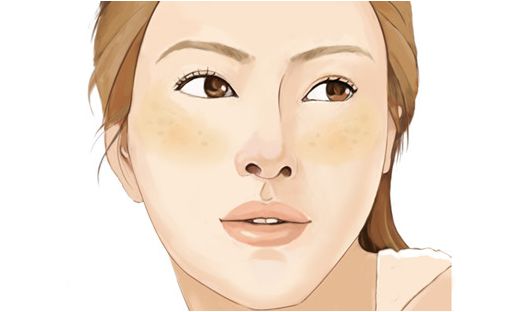 常见皮肤色斑有哪些怎么鉴别,面部色斑的鉴别诊断视频