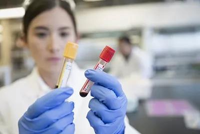 甲功有必要查五项吗,查甲功一般查五项还是七项