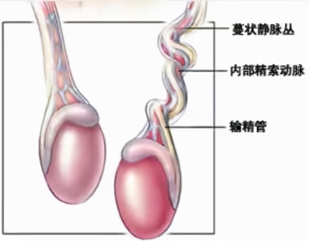 睾丸扭转坏死不切除危害,睾丸扭转坏死切除算不算意外
