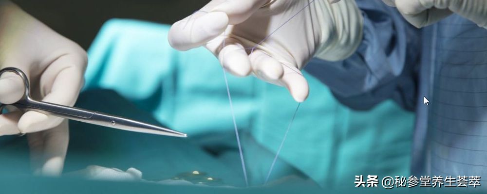 如何保养子宫吃什么药,子宫下垂做了修补手术怎么保养的