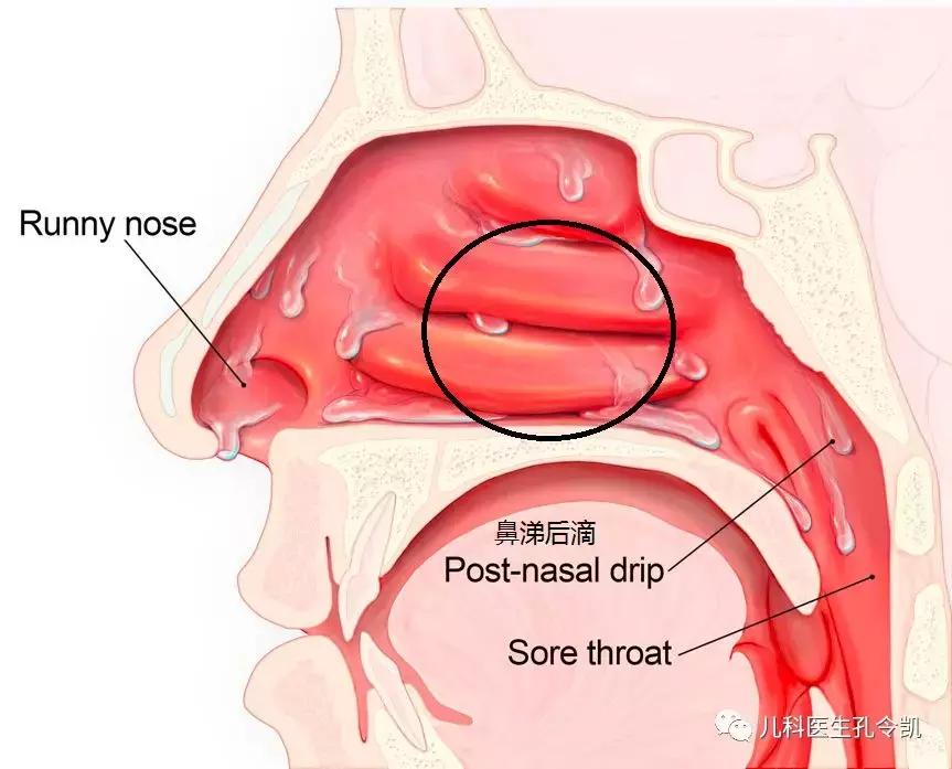 一岁宝宝感冒半夜咳嗽白天不咳嗽,小孩感冒后咳嗽怎么办最有效