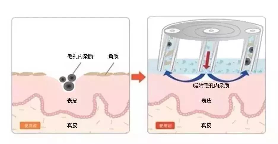 闺蜜因为一件小事绝交了,闺蜜因为一点小事闹翻