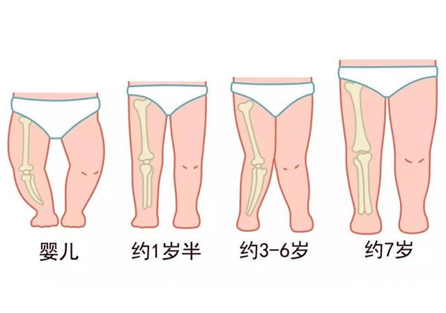 宝宝w型坐姿改不过来怎么办,孩子喜欢跪坐坐姿危害