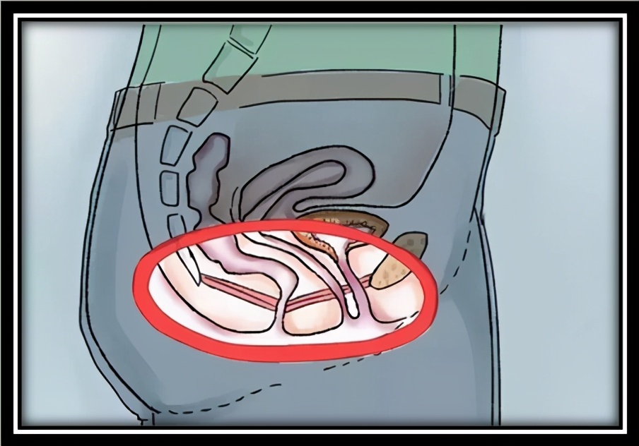 产后漏尿怎么办？——凯格尔运动自行训练的免费良方