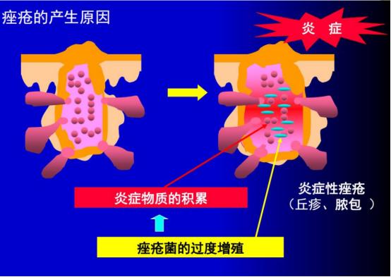 浠欎汉鎺岀棙鑲屼慨鎶よ啅,鐪嬪畬鐥樼棙浠ュ悗鎰熻鏇翠弗閲嶄簡