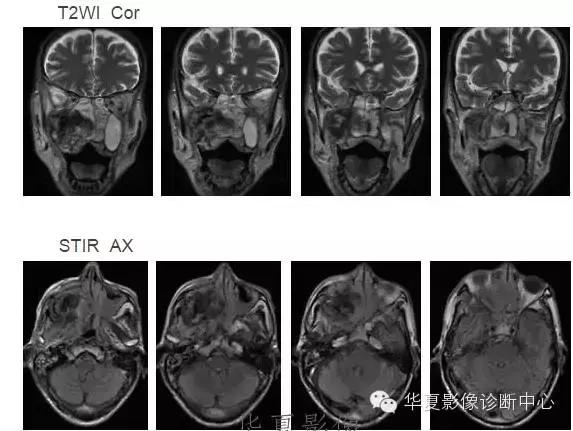 这些部位的黑色素瘤，您会诊断吗？