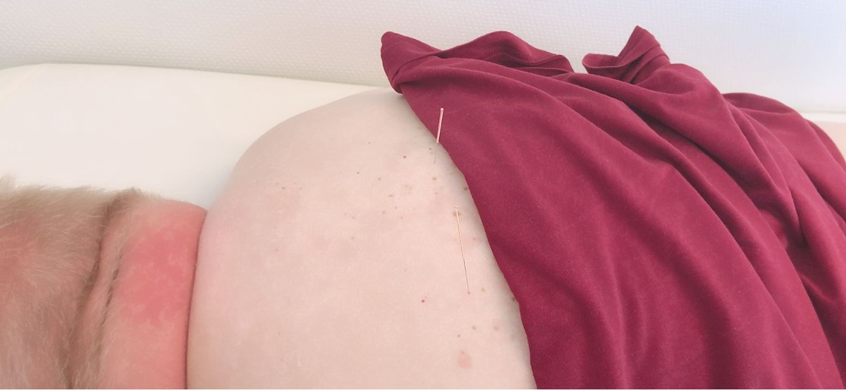 中医治疗肌无力的效果怎么样,中医治疗肌无力的好方子