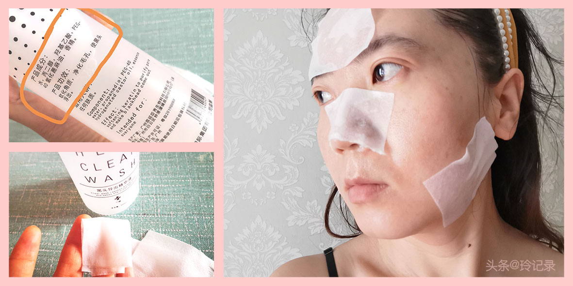 为什么总有螨虫而长痘痘？洗脸顺序、涂抹方式的小技巧