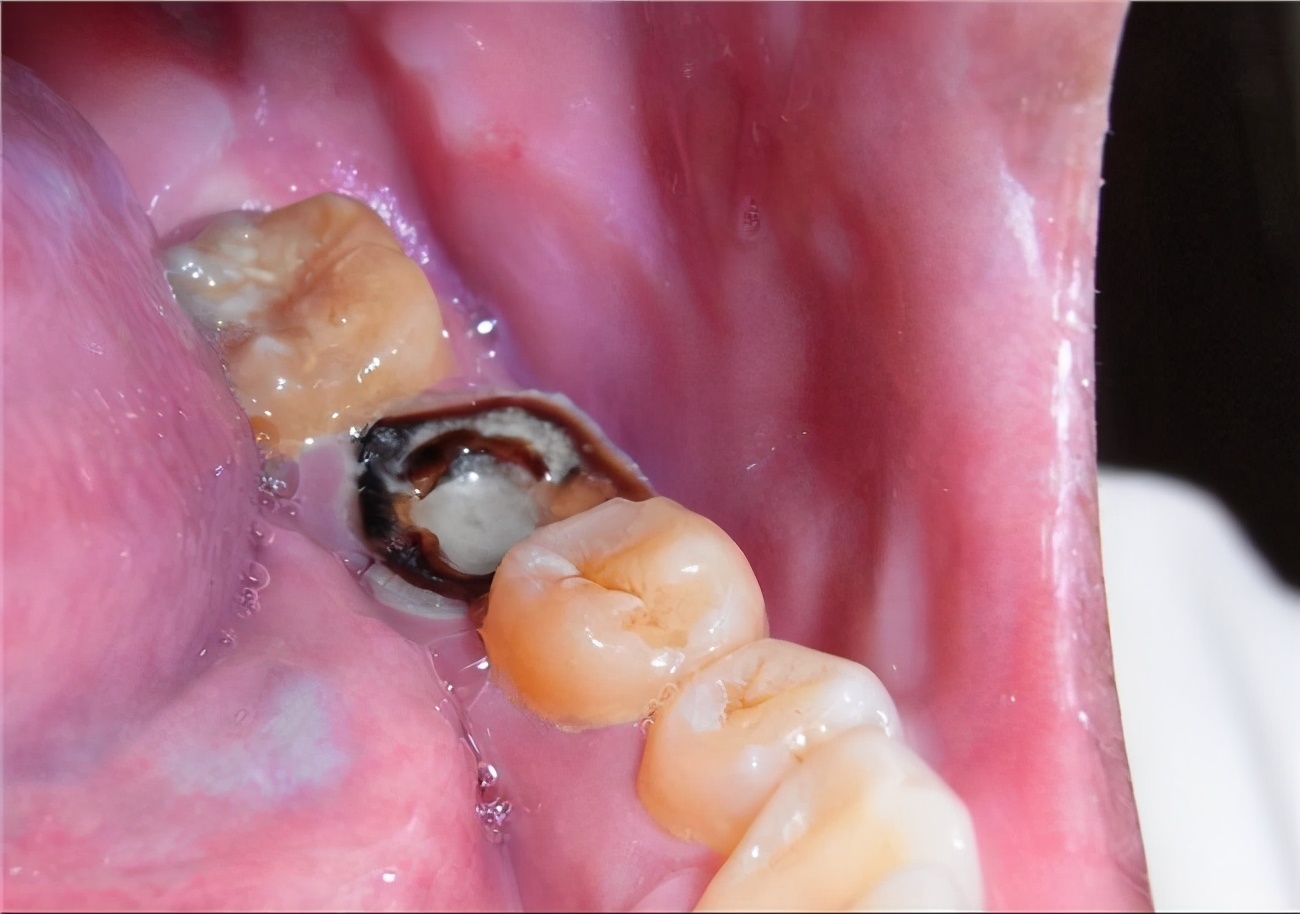 牙膏护肤套装推荐女士,护肤牙膏