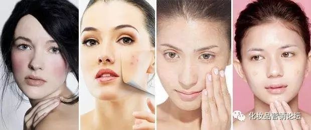 脸上毛孔粗大黑头粉刺多怎么改善,脸上都是黑头粉刺毛孔粗大怎么弄