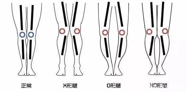 腿不直穿什么好看,腿不直的女生穿衣技巧