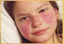 风湿病如何锻炼身体,在家怎样自己调理风湿类风湿教程