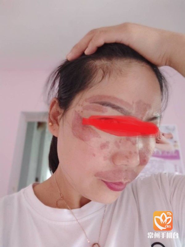 深度调查祛斑美容,祛斑美容内幕
