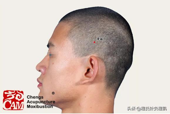 面瘫面神经炎中医调理方法,小儿面神经炎中医如何治疗