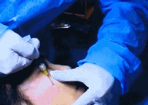 同时得艾滋病梅毒乙肝是什么后果,艾滋病梅毒乙肝会通过尿液传播吗