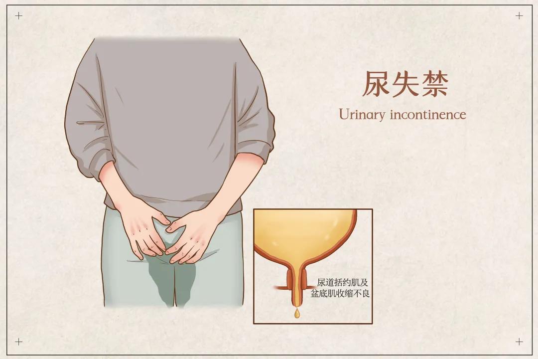 尿急尿频尿失禁的原因,尿急尿频尿失禁的根本原因是什么