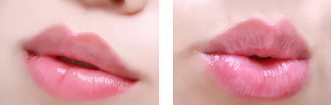 嘴唇不再干燥起皮温和润唇,秋冬唇干燥起皮