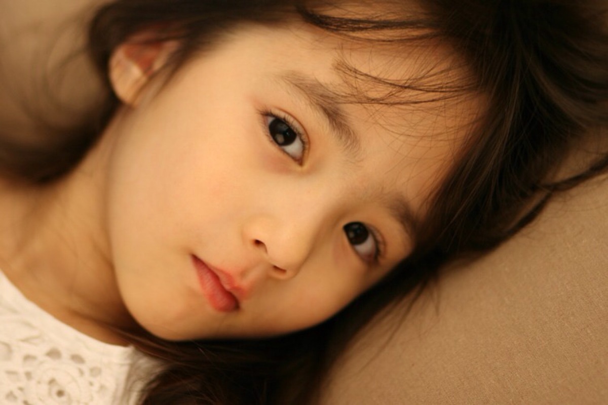 怎样去除脸上的红血丝和高原红,怀孕以后脸上出现高原红什么原因