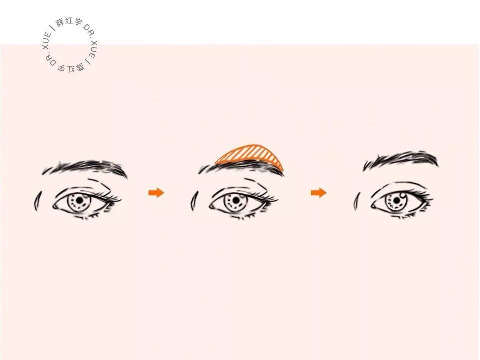 明星逃不过的年龄,眼睛衰老比较明显的明星