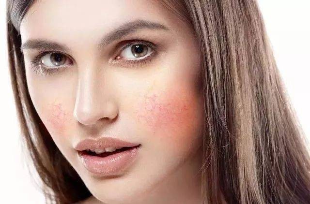 干皮又出油的皮肤怎么护肤,混油皮怎样改善皮肤敏感