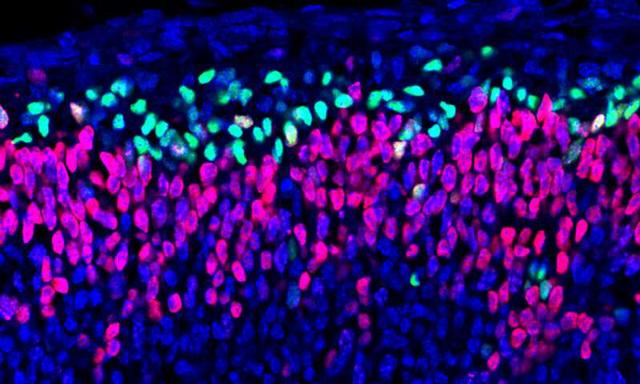 大脑皮层的进化历程,大脑神经元的成长过程
