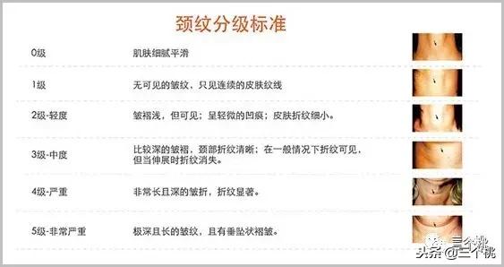 医美去颈纹全过程,去颈纹医美过程