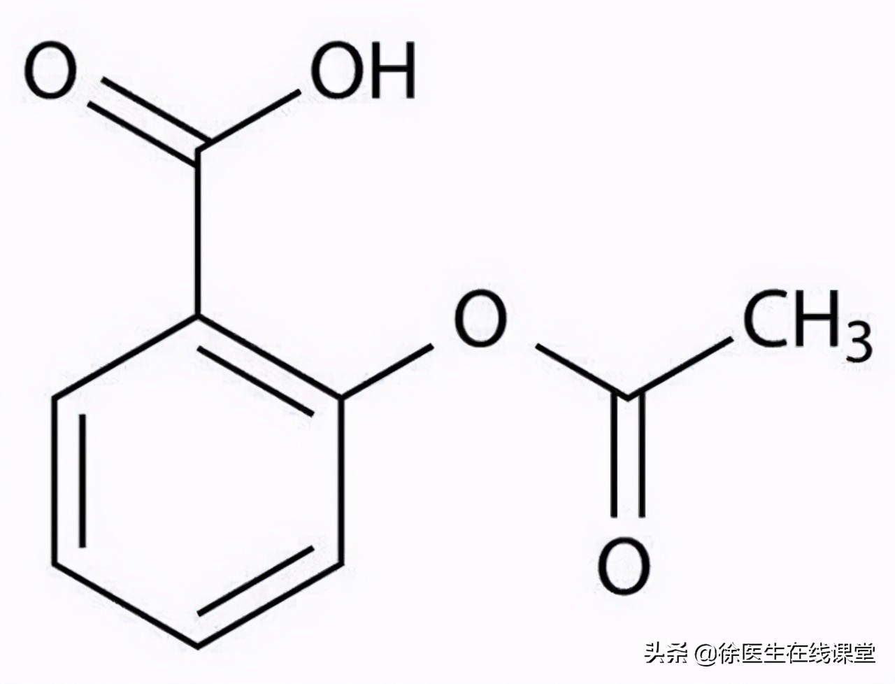 又一患者擅自服用阿司匹林导致胃出血！掌握2点，降低出血风险