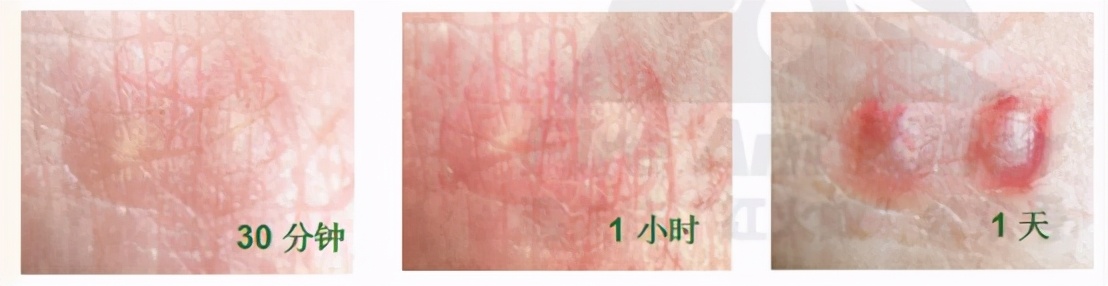 南沙|@东涌街坊,专家建议,红火蚁得这样治