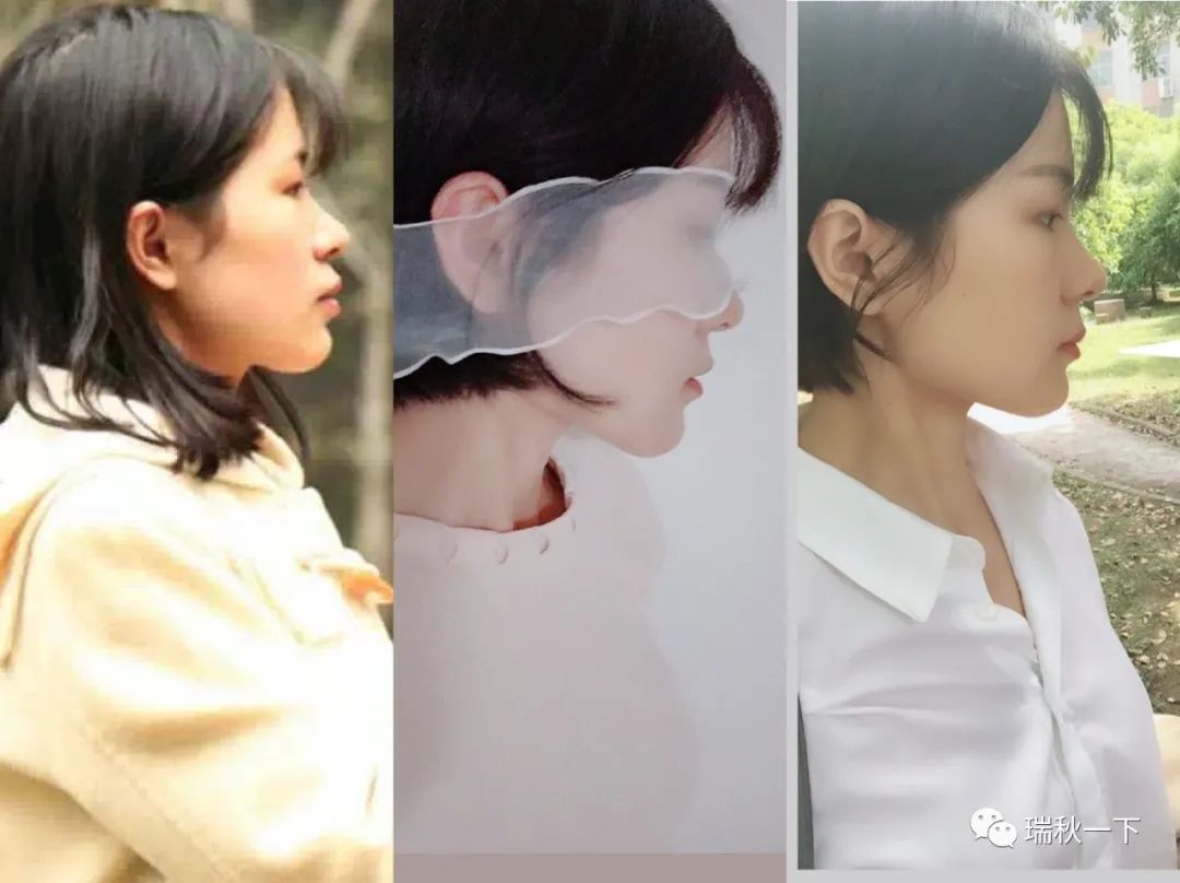 牙齿矫正,你后悔了吗?