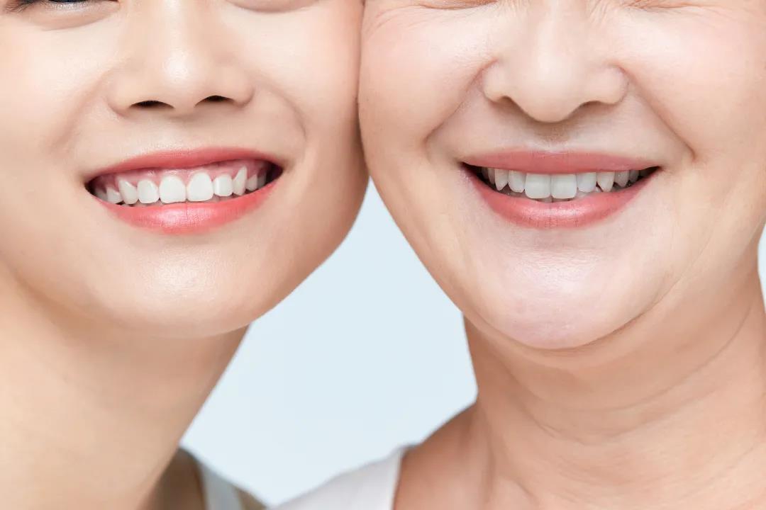 法令纹的医美解决方法能管多久,法令纹断崖式的衰老怎么办