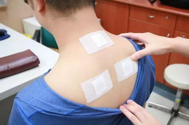 冬病夏治可以调理哪些疾病,专家说的冬病夏治